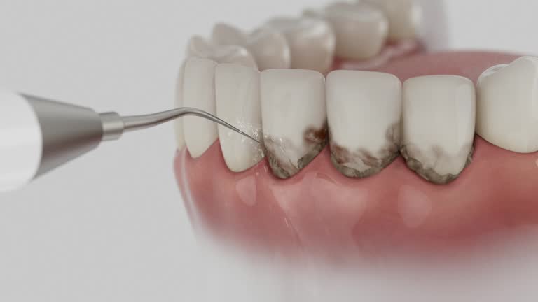 Reliable Dental contractor in Paulsboro, NJ by Dentist Open Now